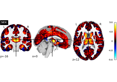 ../_images/sphx_glr_plot_brain_age_sex_statistics_residualization_thumb.png